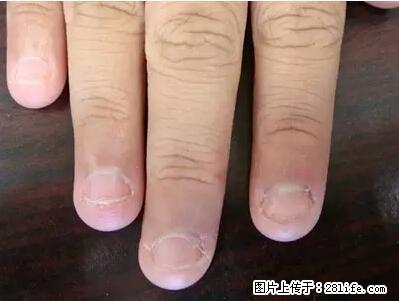 剪指甲、挖耳屎，这些日常小动作竟隐藏大危害！ - 商洛生活资讯 - 商洛28生活网 sl.28life.net